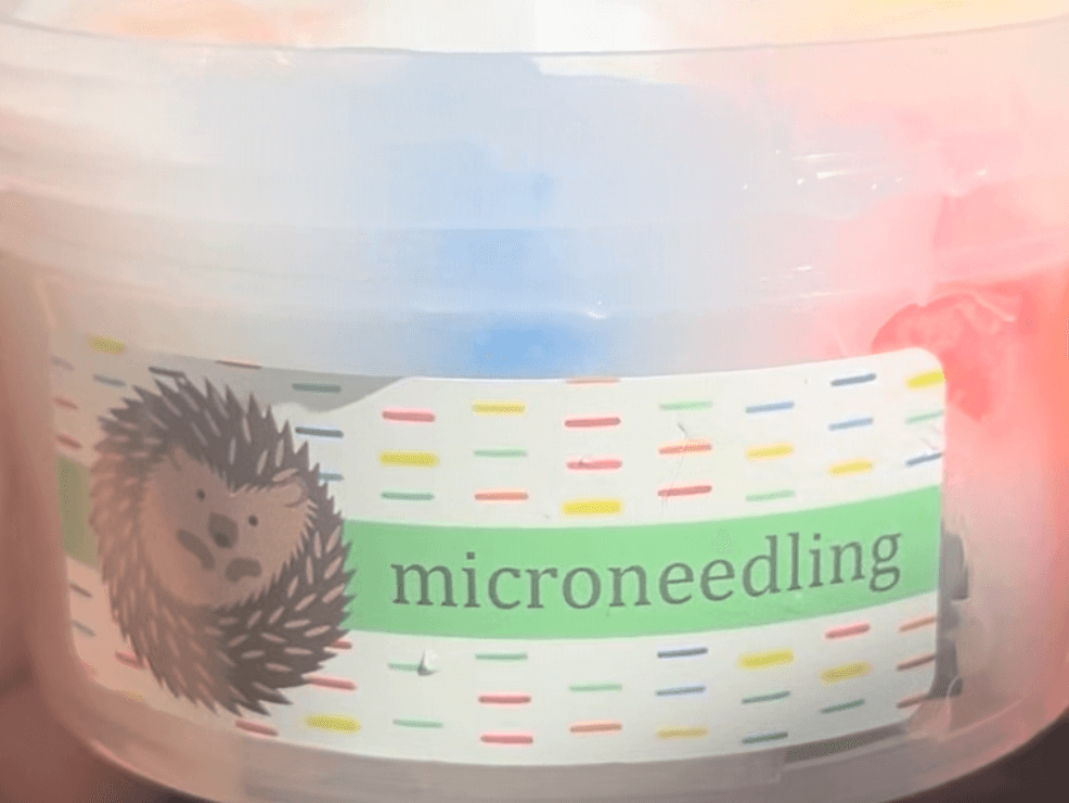 microneedling